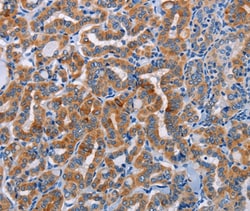 Invitrogen ALG12 Polyclonal Antibody 100 &mu;L; Unconjugated:Antibodies,