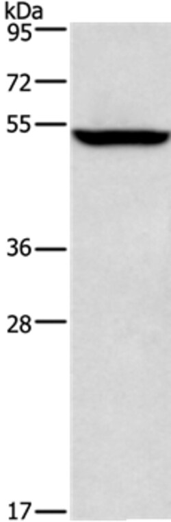 Invitrogen ALG12 Polyclonal Antibody 100 &mu;L | Buy Online | Invitrogen&trade; | Fisher Scientific