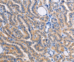 Invitrogen ALG8 Polyclonal Antibody 100 &mu;L; Unconjugated:Antibodies,