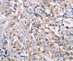 Invitrogen ALG8 Polyclonal Antibody 100 &mu;L; Unconjugated:Antibodies,