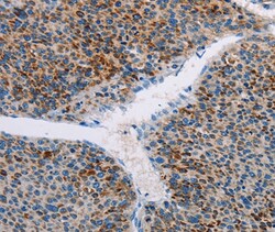 Invitrogen AMOTL2 Polyclonal Antibody 100 &mu;L; Unconjugated:Antibodies,