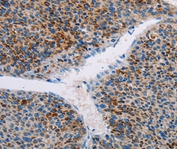 Invitrogen APOBEC4 Polyclonal Antibody 100 &mu;L; Unconjugated:Antibodies,