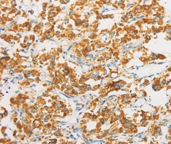Invitrogen IDH3B Polyclonal Antibody 100 &mu;L; Unconjugated:Antibodies,