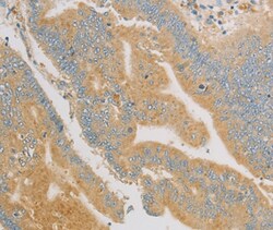 Invitrogen KLF17 Polyclonal Antibody 100 &mu;L; Unconjugated:Antibodies,