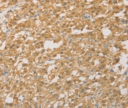 Invitrogen PGK2 Polyclonal Antibody 100 &mu;L; Unconjugated:Antibodies,
