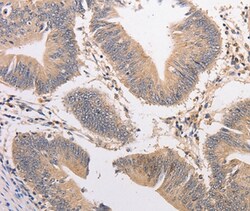Invitrogen PIP5K1A Polyclonal Antibody 100 &mu;L; Unconjugated:Antibodies,