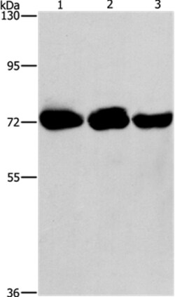 Invitrogen PIP5K1A Polyclonal Antibody 100 &mu;L | Buy Online | Invitrogen&trade; | Fisher Scientific