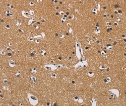 Invitrogen CBY1 Polyclonal Antibody 100 &mu;L; Unconjugated:Antibodies,