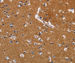 Invitrogen GPM6A Polyclonal Antibody 100 &mu;L; Unconjugated:Antibodies,
