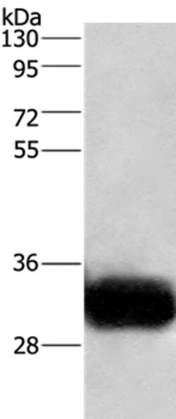Invitrogen GPM6A Polyclonal Antibody 100 &mu;L | Buy Online | Invitrogen&trade; | Fisher Scientific