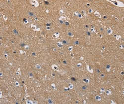 Invitrogen GSTA2 Polyclonal Antibody 100 &mu;L; Unconjugated:Antibodies,