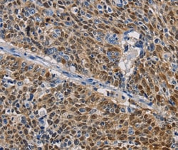Invitrogen GSTA2 Polyclonal Antibody 100 &mu;L; Unconjugated:Antibodies,