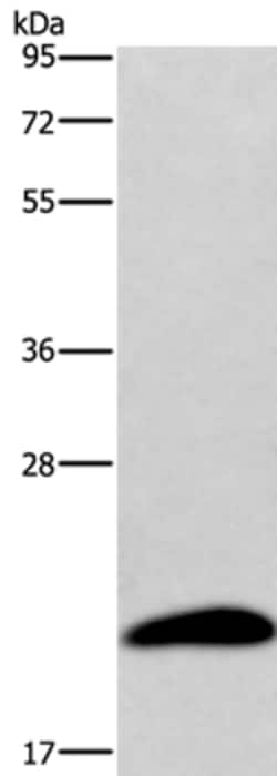 Invitrogen AURKAIP1 Polyclonal Antibody 100 &mu;L; Unconjugated:Antibodies,