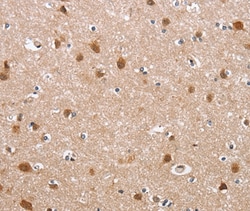 Invitrogen Defensin 6 Polyclonal Antibody 100 &mu;L; Unconjugated:Antibodies,