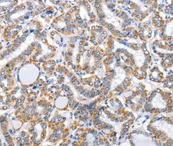 Invitrogen ARL11 Polyclonal Antibody 100 &mu;L; Unconjugated:Antibodies,