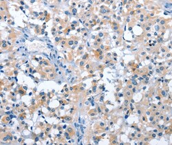 Invitrogen ASB2 Polyclonal Antibody 100 &mu;L; Unconjugated:Antibodies,