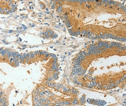 Invitrogen BAAT Polyclonal Antibody 100 μL; Unconjugated:Antibodies,