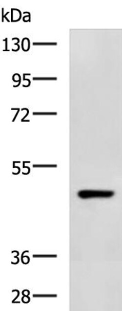 Invitrogen C3a Receptor Polyclonal Antibody 100 &mu;L; Unconjugated:Antistoffer