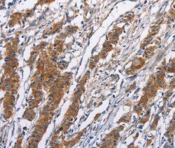 Invitrogen NCAPD3 Polyclonal Antibody 100 &mu;L | Buy Online | Invitrogen&trade; | Fisher Scientific