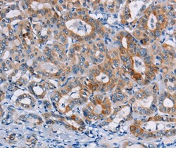 Invitrogen CASC3 Polyclonal Antibody 100 &mu;L; Unconjugated:Antibodies,