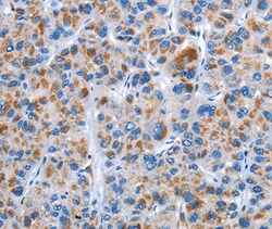 Invitrogen CENPJ Polyclonal Antibody 100 &mu;L; Unconjugated:Antibodies,