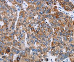 Invitrogen CHDH Polyclonal Antibody 100 &mu;L; Unconjugated:Antibodies,