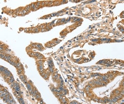 Invitrogen CKAP2 Polyclonal Antibody 100 &mu;L; Unconjugated:Antibodies,
