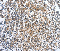 Invitrogen CKAP2 Polyclonal Antibody 100 &mu;L; Unconjugated:Antibodies,