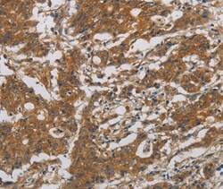 Invitrogen CNDP1 Polyclonal Antibody 100 &mu;L; Unconjugated:Antibodies,