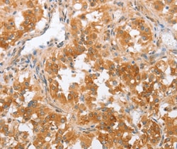 Invitrogen CRELD2 Polyclonal Antibody 100 &mu;L; Unconjugated:Antibodies,
