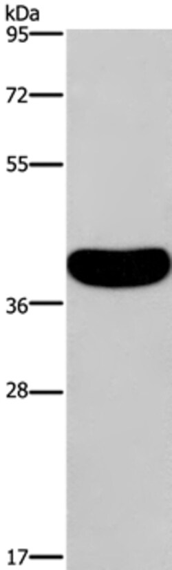 Invitrogen CRELD2 Polyclonal Antibody 100 &mu;L | Buy Online | Invitrogen&trade; | Fisher Scientific