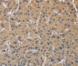 Invitrogen CYFIP2 Polyclonal Antibody 100 &mu;L | Buy Online | Invitrogen&trade; | Fisher Scientific