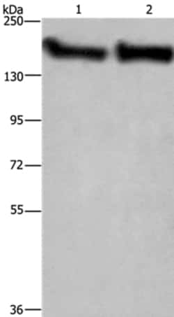 Invitrogen CYFIP2 Polyclonal Antibody 100 &mu;L | Buy Online | Invitrogen&trade; | Fisher Scientific
