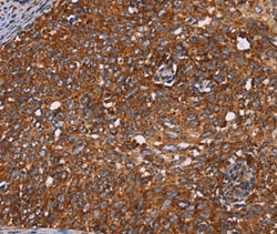 Invitrogen CYP2W1 Polyclonal Antibody 100 &mu;L; Unconjugated:Antibodies,