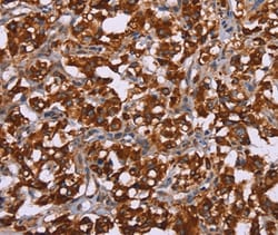 Invitrogen CYP2W1 Polyclonal Antibody 100 &mu;L; Unconjugated:Antibodies,