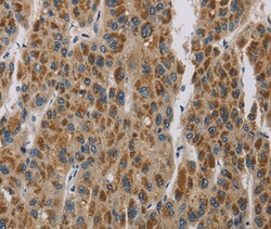 Invitrogen LOXL4 Polyclonal Antibody 100 &mu;L; Unconjugated:Antibodies,