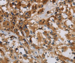 Invitrogen LOXL4 Polyclonal Antibody 100 &mu;L; Unconjugated:Antibodies,