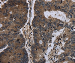 Invitrogen BRINP1 Polyclonal Antibody 100 &mu;L; Unconjugated:Antibodies,