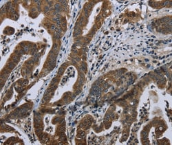 Invitrogen BRINP1 Polyclonal Antibody 100 &mu;L; Unconjugated:Antibodies,