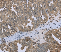 Dynactin 4 Polyclonal Antibody:Antibodies, Polyclonal