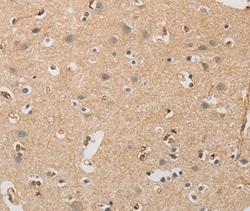 Invitrogen DCTN5 Polyclonal Antibody 100 &mu;L; Unconjugated:Antibodies,