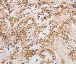 Invitrogen DCTN5 Polyclonal Antibody 100 &mu;L; Unconjugated:Antibodies,
