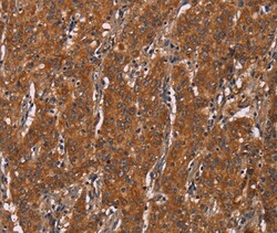 Invitrogen DCTN6 Polyclonal Antibody 100 &mu;L; Unconjugated:Antibodies,