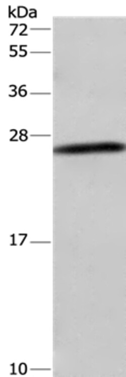 Invitrogen DCTN6 Polyclonal Antibody 100 &mu;L; Unconjugated:Antibodies,
