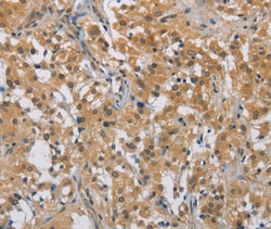 Invitrogen DDX43 Polyclonal Antibody 100 &mu;L; Unconjugated:Antibodies,
