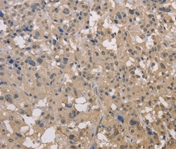 Invitrogen DRG1 Polyclonal Antibody 100 &mu;L; Unconjugated:Antibodies,
