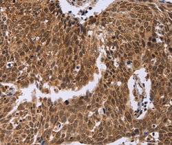 Invitrogen ERCC6L Polyclonal Antibody 100 &mu;L; Unconjugated:Antibodies,