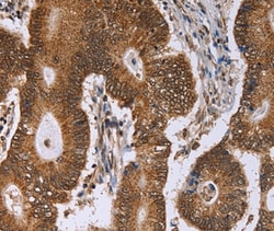 Invitrogen ERCC6L Polyclonal Antibody 100 &mu;L; Unconjugated:Antibodies,