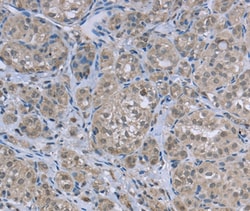 Invitrogen FAR2 Polyclonal Antibody 100 &mu;L; Unconjugated:Antibodies,