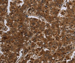 Invitrogen FASTKD1 Polyclonal Antibody 100 &mu;L; Unconjugated:Antibodies,